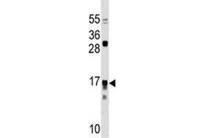 IL17RC antibody western blot analysis in Jurkat lysate. (IL17RC antibody  (AA 103-131))