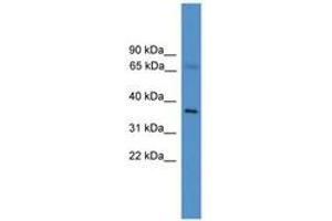 Image no. 1 for anti-Elongation Factor, RNA Polymerase II, 2 (ELL2) (C-Term) antibody (ABIN6746160) (ELL2 antibody  (C-Term))