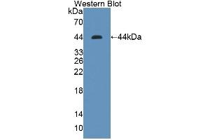 Detection of Recombinant KLF15, Human using Polyclonal Antibody to Kruppel Like Factor 15 (KLF15)