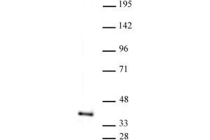 ATF1 antibody (pAb) tested by Western blot. (AFT1 antibody  (C-Term))
