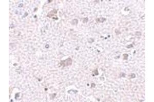 Immunohistochemistry of CDNF in human brain tissue with CDNF antibody at 2. (CDNF antibody  (C-Term))