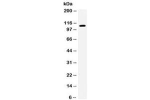 Western blot testing of human 293 cell lysate with EPHB1 antibody. (EPH Receptor B1 antibody)