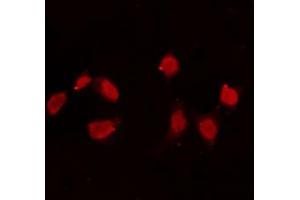 ABIN6274165 staining Hela cells by IF/ICC. (Topoisomerase II alpha antibody  (Internal Region))
