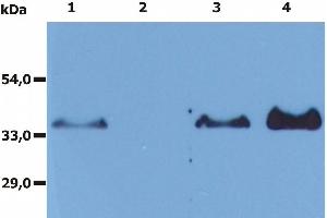 Immunoprecipitation of human CD20 from the whole cell lysate of RAJI human Burkitt lymphoma cell line. (CD20 antibody)