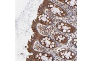 Immunohistochemical staining of human rectum with IVNS1ABP polyclonal antibody  shows strong cytoplasmic positivity in glandular cells at 1:50-1:200 dilution.