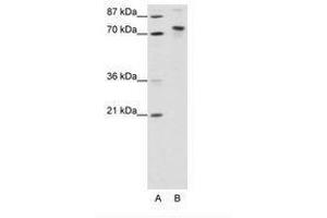 Image no. 1 for anti-TOX High Mobility Group Box Family Member 4 (TOX4) (N-Term) antibody (ABIN307424) (TOX4 antibody  (N-Term))