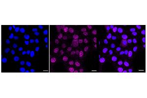 anti-Nuclear Receptor Subfamily 2, Group E, Member 1 (NR2E1) antibody