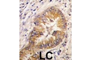 Immunohistochemistry (IHC) image for anti-Cell Division Cycle Associated 8 (CDCA8) antibody (ABIN2998016)