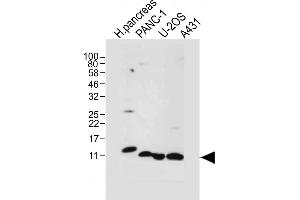 All lanes : Anti-REG3A Antibody (N-term) at 1:1000 dilution Lane 1: Human ncreas tissue lysate Lane 2: NC-1 whole cell lysate Lane 3: U-2OS whole cell lysate Lane 4: A431 whole cell lysate Lysates/proteins at 20 μg per lane. (REG3A antibody  (N-Term))
