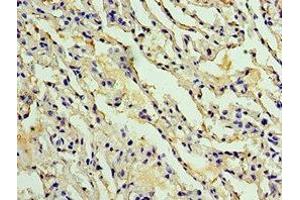 Immunohistochemistry of paraffin-embedded human lung tissue using ABIN7142914 at dilution of 1:100 (AKAP8L antibody  (AA 1-240))
