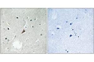 Immunohistochemistry analysis of paraffin-embedded human brain, using PYK2 (Phospho-Tyr579) Antibody. (PTK2B antibody  (pTyr579))