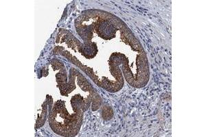 Immunohistochemical staining of human prostate with KBTBD8 polyclonal antibody  shows strong cytoplasmic positivity in glandular cells. (KBTBD8 antibody)