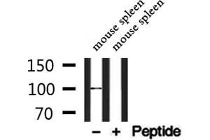 Western blot analysis of extracts from mouse spleen, using BCAM Antibody. (BCAM antibody  (C-Term))