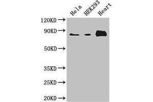 Western Blot Positive WB detected in: Hela whole cell lysate, HEK293 whole cell lysate, Mouse heart tissue All lanes: ABLIM1 antibody at 3. (ABLIM1 antibody  (AA 174-319))