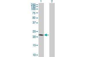 Western Blot analysis of AK1 expression in transfected 293T cell line by AK1 MaxPab polyclonal antibody. (Adenylate Kinase 1 antibody  (AA 1-194))