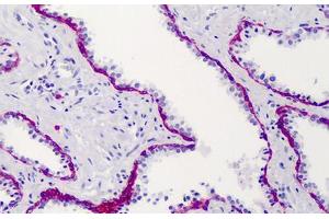 Human Prostate: Formalin-Fixed, Paraffin-Embedded (FFPE) (Syndecan 1 antibody)