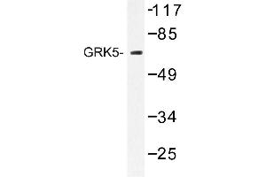 Image no. 1 for anti-G Protein-Coupled Receptor Kinase 5 (GRK5) antibody (ABIN272181) (GRK5 antibody)