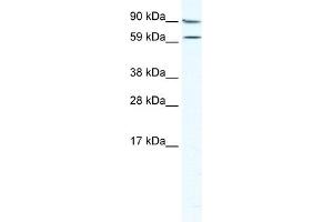 WB Suggested Anti-MTA2 Antibody Titration:  5. (MTA2 antibody  (Middle Region))