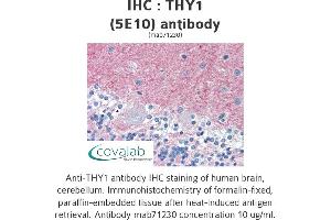 Image no. 3 for anti-CD90 (THY1) antibody (ABIN1724058)