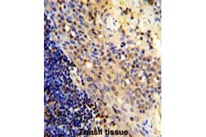 Formalin-fixed and paraffin-embedded human tonsilreacted with CD8A polyclonal antibody , which was peroxidase-conjugated to the secondary antibody, followed by AEC staining. (CD8 alpha antibody  (N-Term))