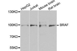 Western blot analysis of extracts of various cells, using BRAF antibody. (BRAF antibody)