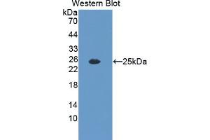 Detection of Recombinant IL35, Mouse using Polyclonal Antibody to Interleukin 35 (IL35) (Interleukin 35 antibody  (AA 23-215))