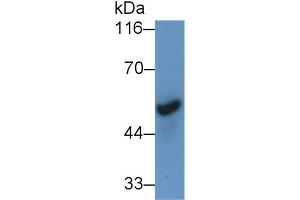Detection of CHRNa7 in Mouse Cerebrum lysate using Polyclonal Antibody to Cholinergic Receptor, Nicotinic, Alpha 7 (CHRNa7) (CHRNA7 antibody  (AA 23-230))