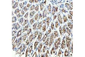 IHC analysis of SP6 using anti-SP6 antibody (ABIN5692945). (SP6 antibody)