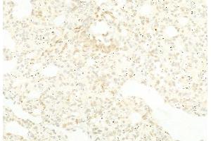 ABIN6264260 and ABIN6268782 at 1/100 staining Rat lung tissue by IHC-P. (PKM2 antibody  (Internal Region))