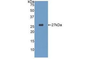 Detection of Recombinant GSTa4, Human using Polyclonal Antibody to Glutathione S Transferase A4 (GSTA4) (GSTA4 antibody  (AA 3-222))