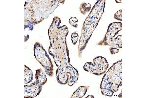 IHC analysis of TTLL2 using anti-TTLL2 antibody (ABIN7600850). (TTLL2 antibody  (AA 24-582))