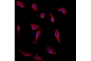 ABIN6260440 and ABIN6272875 staining HepG2 by IF/ICC. (CAMSAP2 antibody  (C-Term))