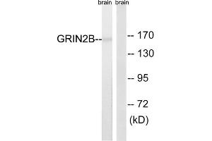 Western blot analysis of extracts from mouse brain cells, using GRIN2B (epitope around residue 1303) antibody. (GRIN2B antibody  (Ser1303))
