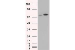 Western Blotting (WB) image for anti-Heat Shock 70kDa Protein 1A (HSPA1A) antibody (ABIN1498743) (HSP70 1A antibody)