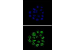 Confocal immunofluorescent analysis of TIEG2 Antibody (N-term) (ABIN390561 and ABIN2840892) with Hela cell followed by Alexa Fluor® 488-conjugated goat anti-rabbit lgG (green).
