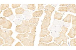 Detection of TNNI2 in Human Skeletal muscle Tissue using Polyclonal Antibody to Troponin I Type 2, Fast Skeletal (TNNI2) (TNNI2 antibody  (AA 1-182))