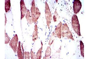 Immunohistochemistry (IHC) image for anti-Ribosomal Protein S6 Kinase, 70kDa, Polypeptide 1 (RPS6KB1) antibody (ABIN969565)