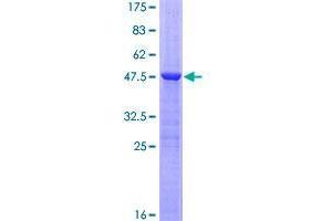 RGS8 Protein (AA 1-198) (GST tag)