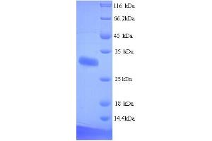 SDS-PAGE (SDS) image for delta-Like 1 Homolog (Drosophila) (DLK1) (AA 24-303) protein (His tag) (ABIN4974570)