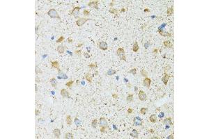 Immunohistochemistry of paraffin-embedded rat brain using COG2 antibody. (COG2 antibody  (AA 1-280))