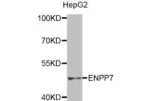 Western blot analysis of extracts of HepG2 cells, using ENPP7 antibody (ABIN5971506) at 1:400 dilution. (ENPP7 antibody)