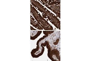 Immunohistochemical staining of human gallbladder with KIAA0753 polyclonal antibody  strong cytoplasmic positivity in glandular cells at 1:50-1:200 dilution.