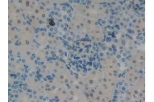 DAB staining on IHC-P; Samples: Rat Kidney Tissue (KRT12 antibody  (AA 398-456))