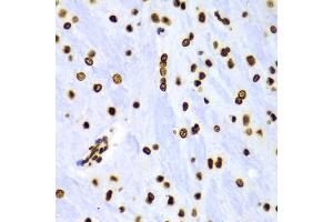 Immunohistochemistry of paraffin-embedded Rat brain using DiMethyl-Histone H3-K4 antibody (ABIN1872995) at dilution of 1:100 (40x lens). (Histone 3 antibody  (H3K4me2))