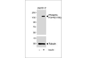 Western blot analysis of lysates from 293T/17 cell line, untreated or treated with insulin(0. (FGFR (pTyr766) antibody)