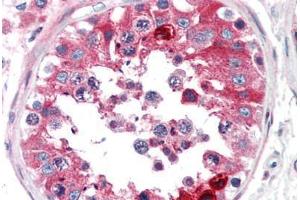 Human Testis (formalin-fixed, paraffin-embedded) stained with CLU antibody ABIN307177 at 5 ug/ml followed by biotinylated anti-mouse IgG secondary antibody ABIN481714, alkaline phosphatase-streptavidin and chromogen. (Clusterin antibody)