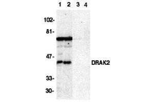Western Blotting (WB) image for anti-serine/threonine Kinase 17b (STK17B) (C-Term) antibody (ABIN1030368) (DRAK2 antibody  (C-Term))