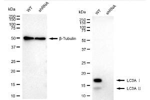 Western blotting analysis using MAP1LC3A antibody (ABIN7799409). (Recombinant MAP1LC3A antibody)