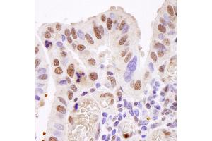 Immunohistochemistry (IHC) image for anti-TAF15 RNA Polymerase II, TATA Box Binding Protein (TBP)-Associated Factor, 68kDa (TAF15) (AA 200-250) antibody (ABIN7448824)