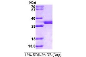 SPR Protein (AA 1-261) (His tag)
